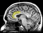 immagine rappresentativa della notizia La ricerca di stimoli e l’impulsività sono collegati all’anatomia del cervello: nuove evidenze dalle neuroscienze